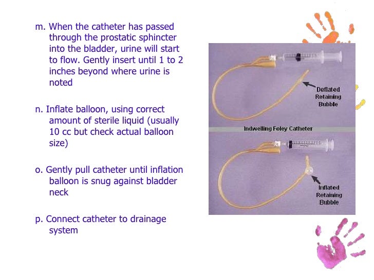 Catheter hole into pee slid